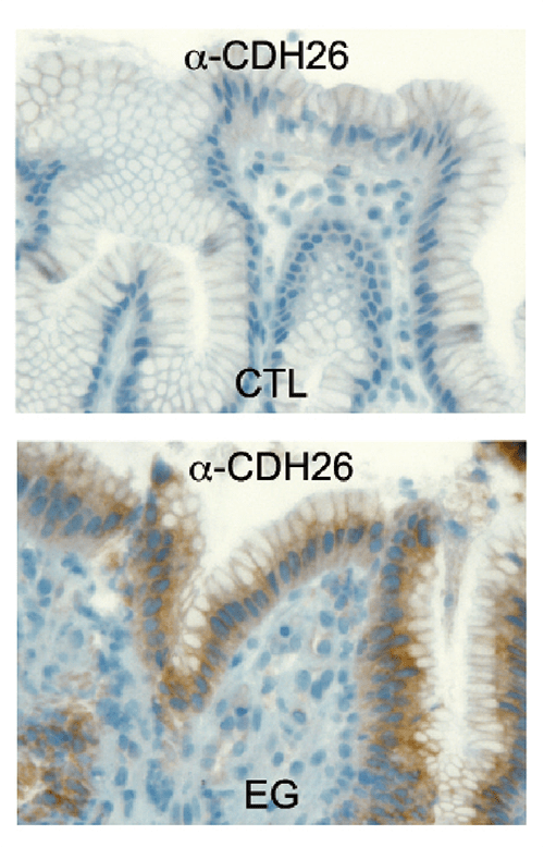 These biopsy specimens were stained to show CDH26 expression and localization in epithelial cells in allergic gastrointestinal tissue. Top: Normal control. Bottom: Eosinophilic gastritis.